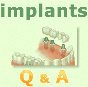 dental implants Q&A