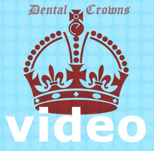 video dental crowns