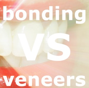 bonding vs veneers